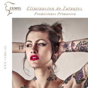 eliminación de tatuajes